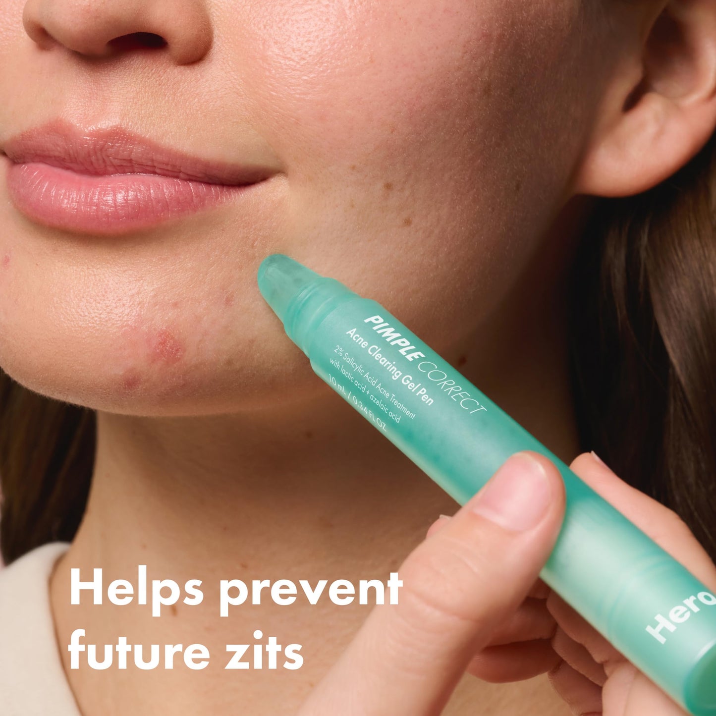 Hero Cosmetics Pimple Correct Acne Clearing Gel Pen - Maximum Strength 2% Salicylic Acid, Derm-Tested Formula for Current and Future Zits (1 Count) Beauty & Personal Care HERO COSMETICS