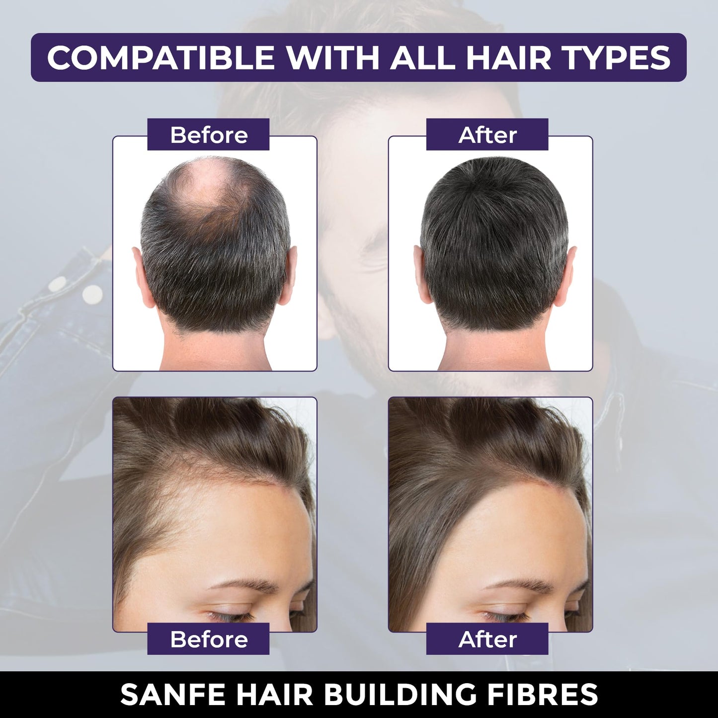 Sanfe Instant Bald Spot Covering Fibers- 22g Beauty and Personal Care Sanfe