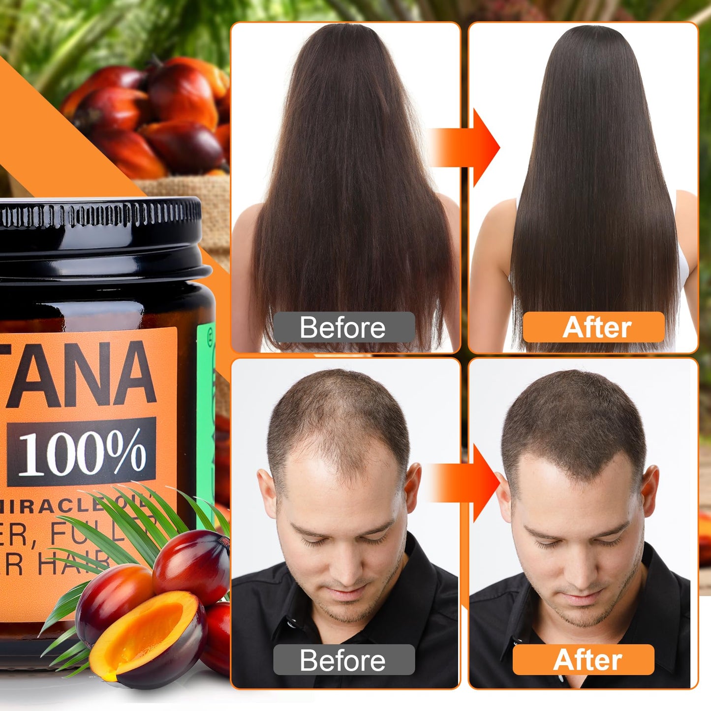WEEMOTD Unrefined Batana Oil for Hair Growth, Dr. Sebi Raw Batana Oil from Honduras, Hair Mask Hair Growth oil with Organic and Natural Ingredients Beauty & Personal Care WEEMOTD