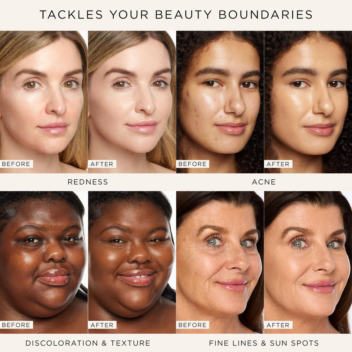 tarte shape tape radiant concealer - Medium-Coverage, Radiant Finish for Under Eye Concealer for Dark Circles, Fine Lines, Redness & Discoloration Beauty & Personal Care tarte