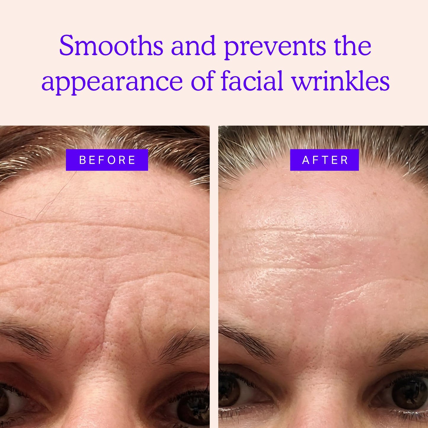 BLUMBODY Face, Forehead Wrinkle Patches - Mini Anti-Wrinkle Facial Patches for Eyes, Mouth, Forehead - Triangle Non-Silicone Face Tape for Elevens Beauty & Personal Care BLUMBODY