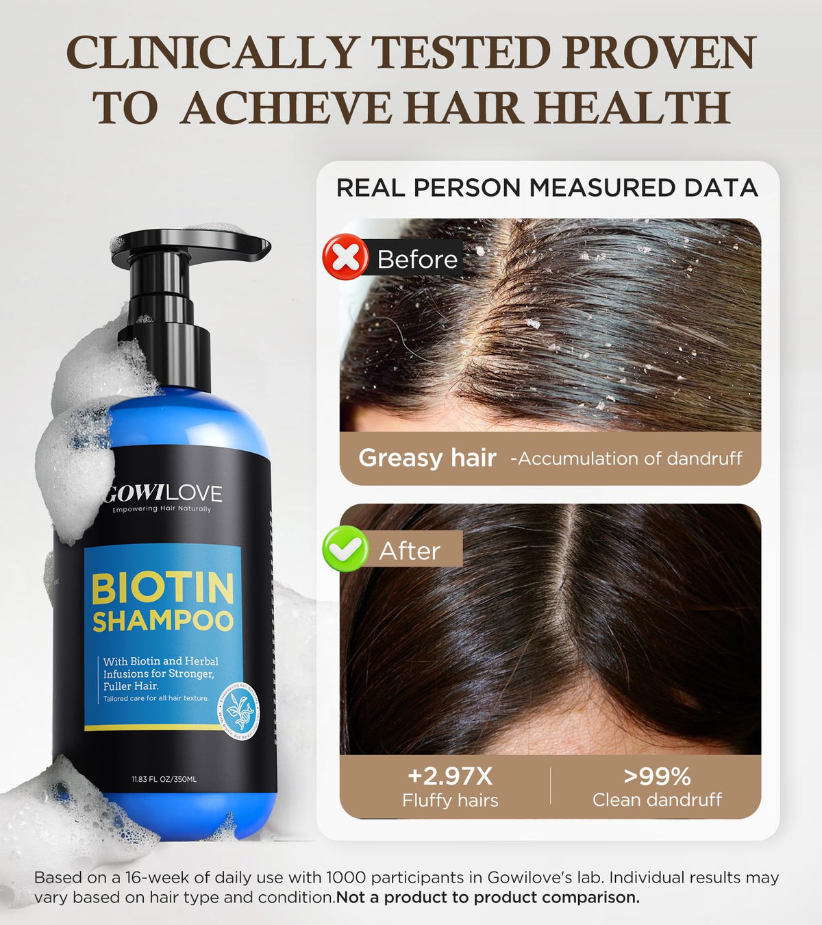 Biotin Shampoo for 3X Faster Hair Growth, 80% Less Hair Loss w/Thuja Extract, Deep Nourishing Hair Care w/Batana Noni Fruit Oil for Softer Shiner