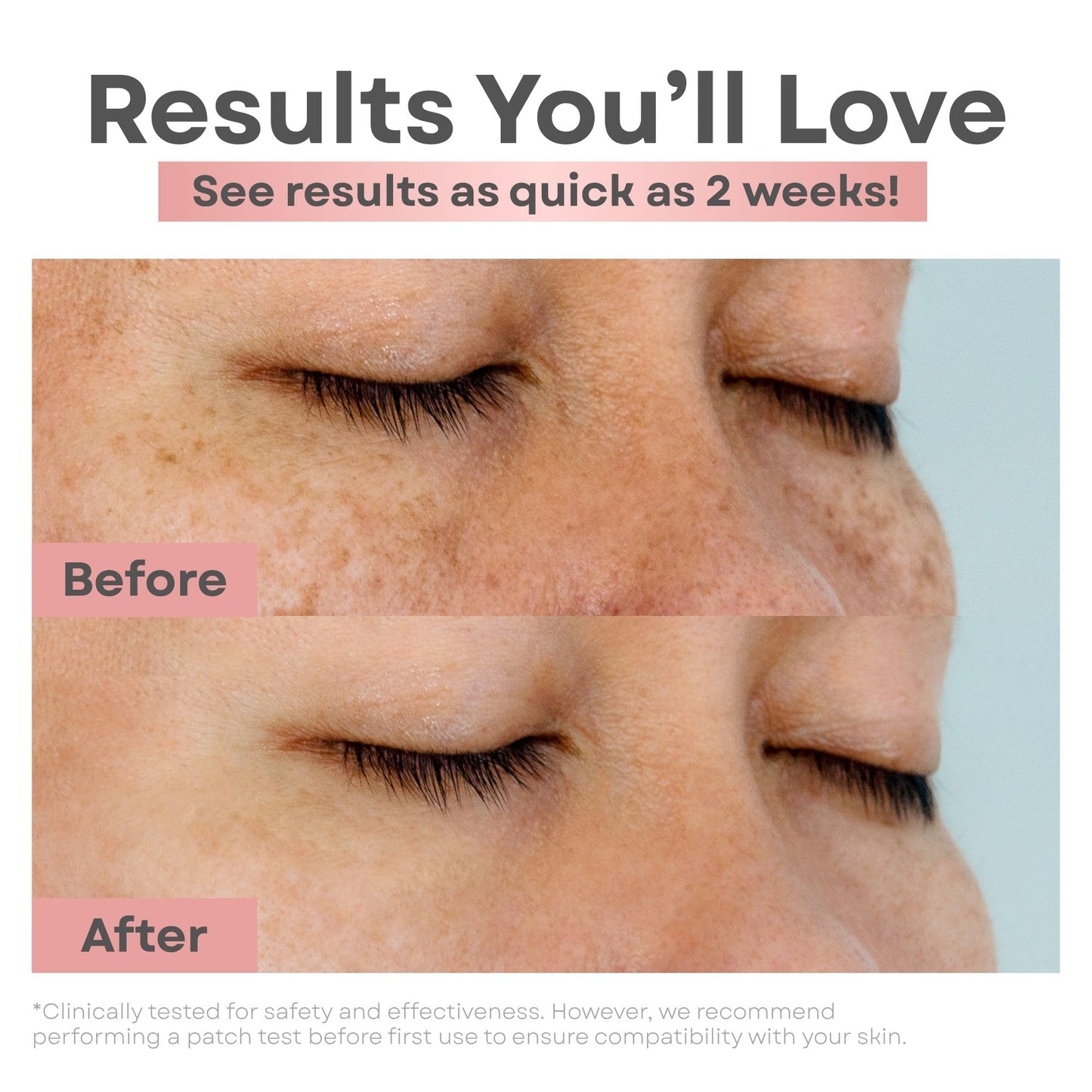 Clear Essence Dark Spot Correcting Serum Wand 0.34 oz | Vitamin C & Niacinamide Face Serum | For Uneven Skin Tone, Dark Spots & Acne Marks | Beauty & Personal Care Clear Essence