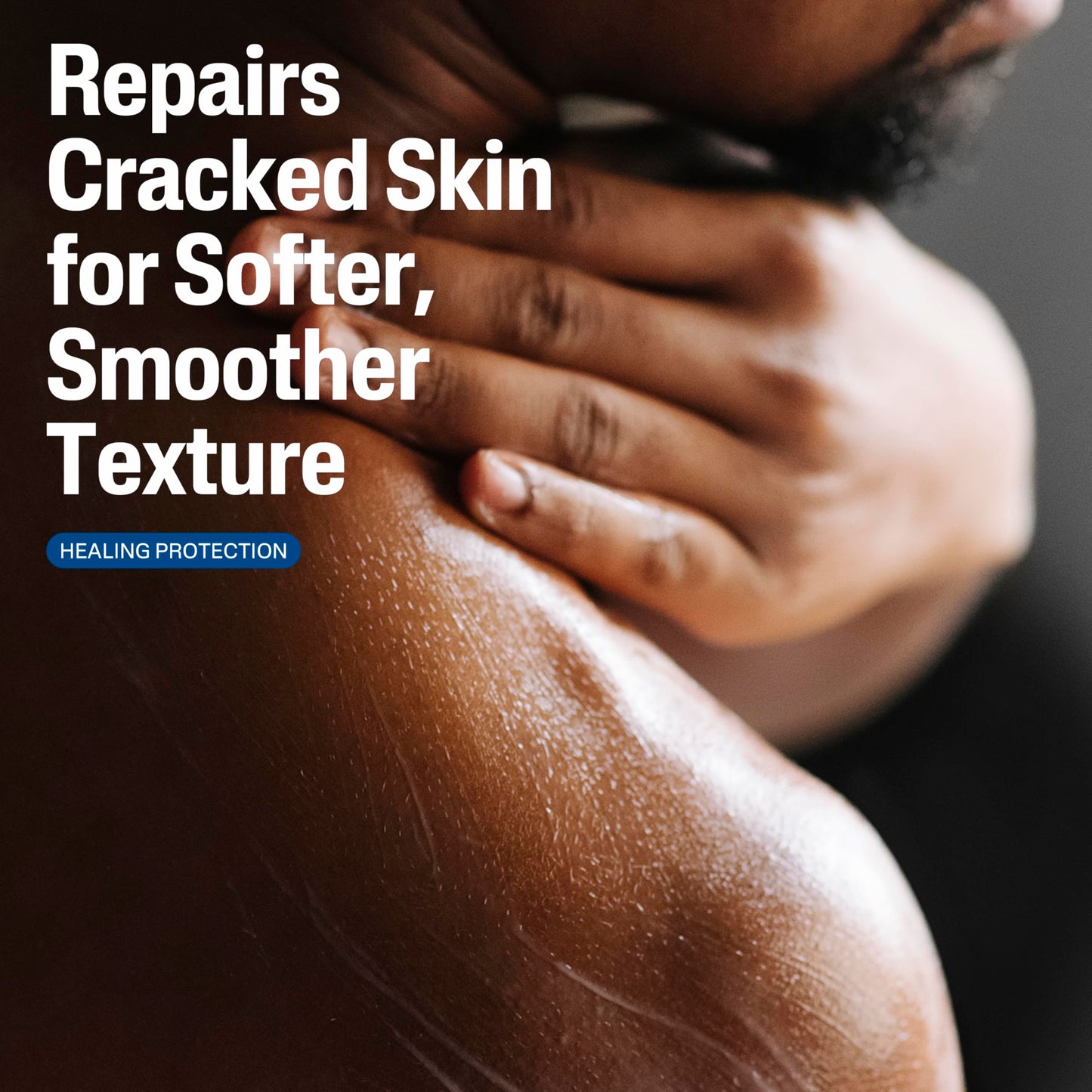 Cetaphil Cracked Skin Repair Lotion, 16 oz, For Very Rough & Cracked, Sensitive Skin, 24 Hour Hydration, Protects & Hydrates Cracked Skin Beauty & Personal Care Cetaphil