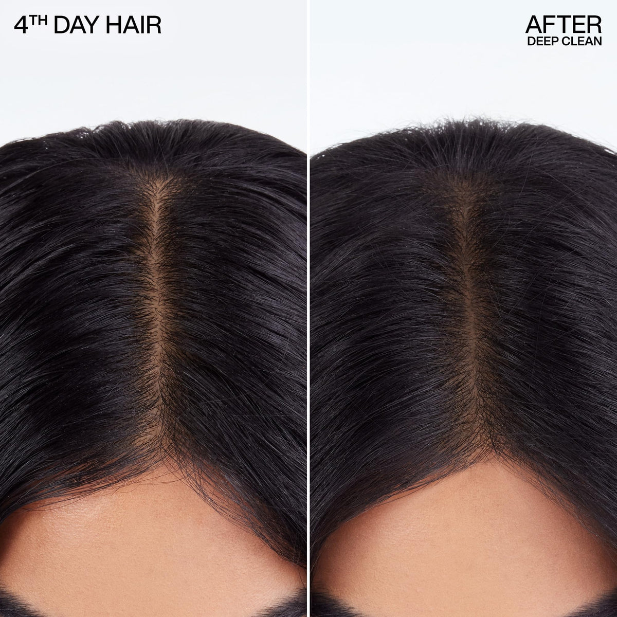 Redken Deep Clean Dry Shampoo - For All Hair Types, 5.2 Oz