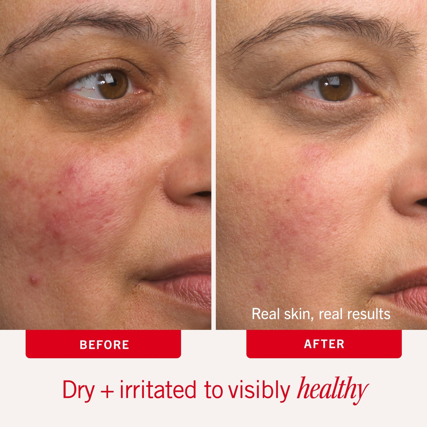 First Aid Beauty - Ultra Repair Cream - Hydrating Face & Body Moisturizer - Whipped Colloidal Oatmeal Clinically Proven to Strengthen Skin Barrier in Beauty and Personal Care First Aid Beauty