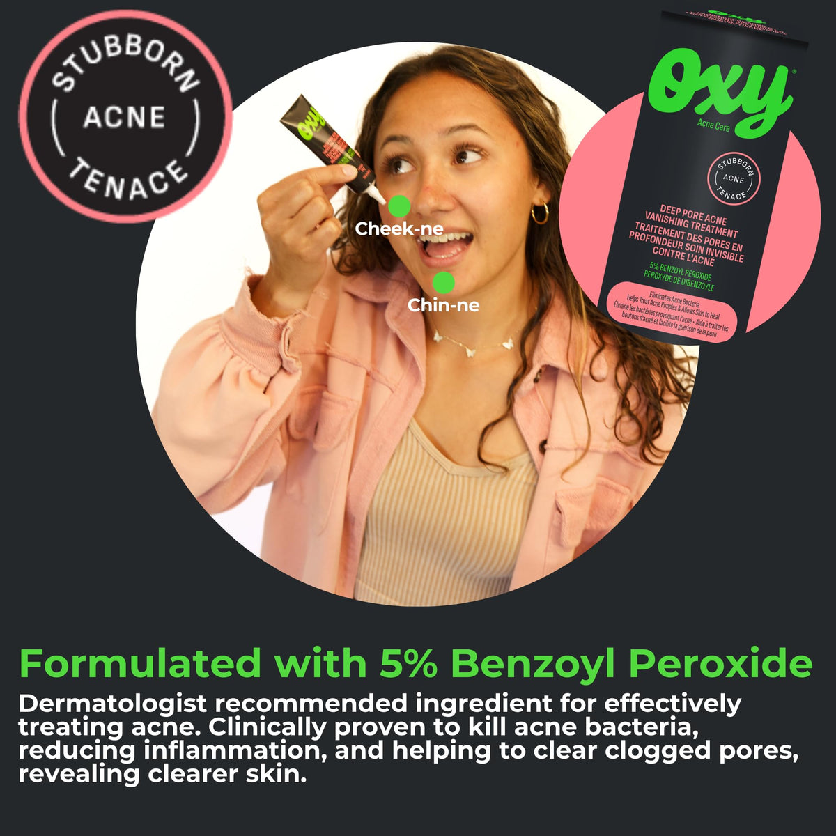 Oxy Acne Vanishing Treatment 0.10-Inches Beauty & Personal Care Oxy