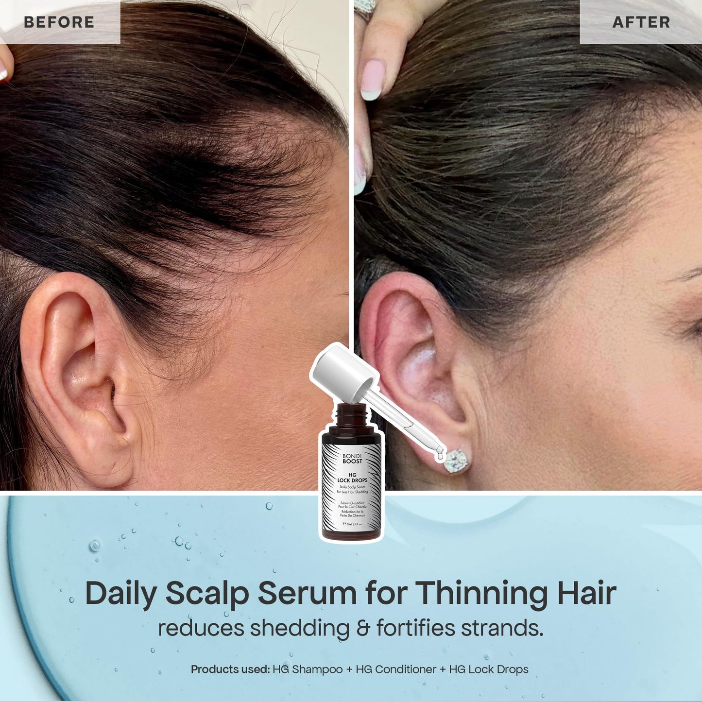 BondiBoost Shed Happens Anti-Thinning Hair Trio - HG Shampoo + Conditioner (90ML) + Lock Drops Serum (30ML) - Reduces Shedding, Supports Fuller Beauty & Personal Care BONDIBOOST