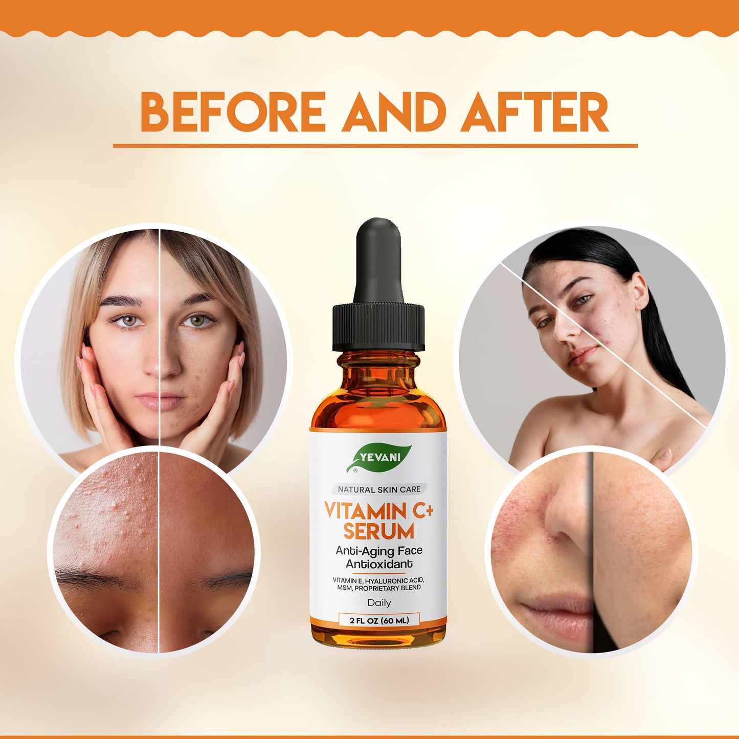 YEVANI 100% Pure Vitamin C Serum for Face with Hyaluronic Acid, Eye Area, Dark Spots, Anti Aging, Hydrating Skin Care with Vitamin E, Aloe Vera Beauty & Personal Care YEVANI