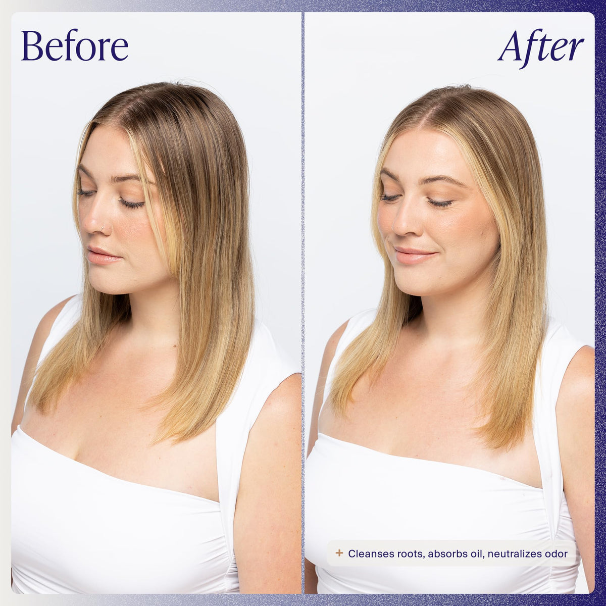 Kenra Platinum Micellar Cleansing Mist | Dry Shampoo Mist | Cleanses Roots, Absorbs Oil and Neutralizes Odor | Refresh and Extend your Style | 5.1 fl