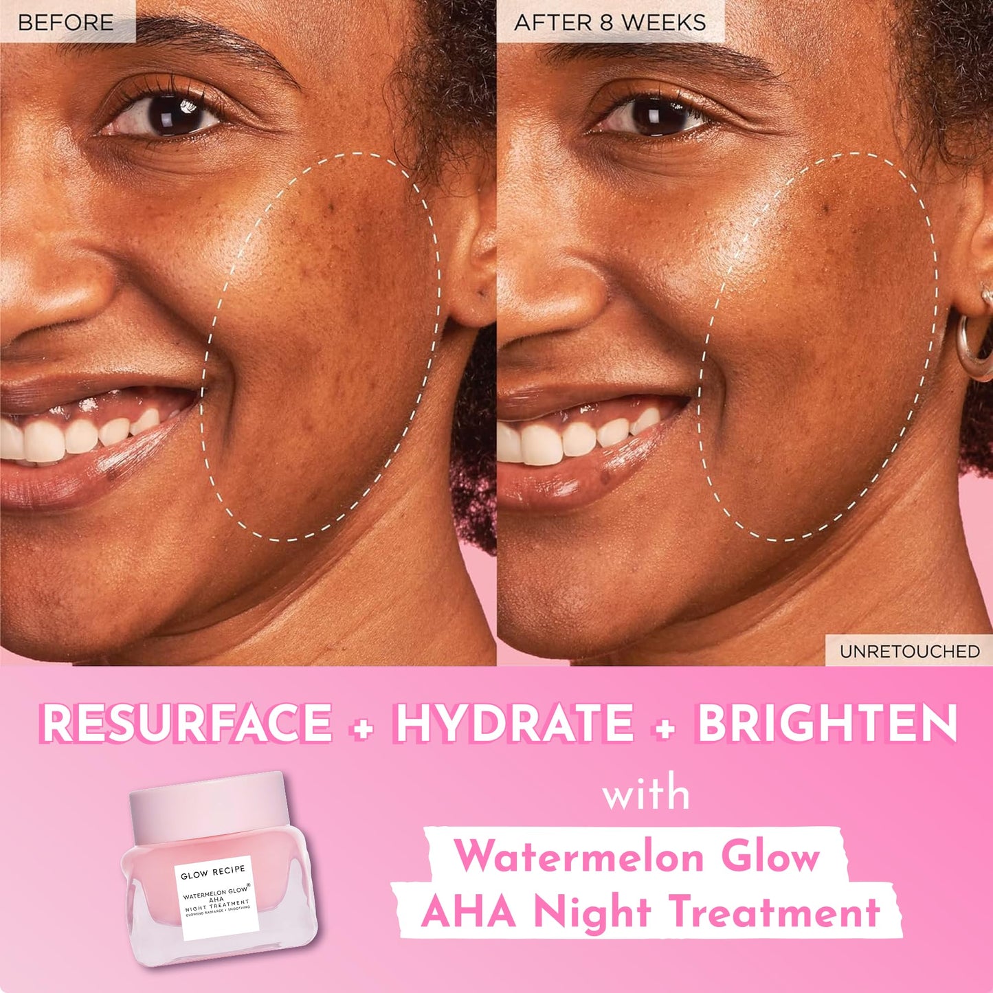 Glow Recipe Watermelon Glow AHA Night Treatment, Travel Size Overnight Mask, AHA Exfoliating Treatment with Glycolic + Lactic Acid, Hyaluronic Acid + Beauty & Personal Care Glow Recipe