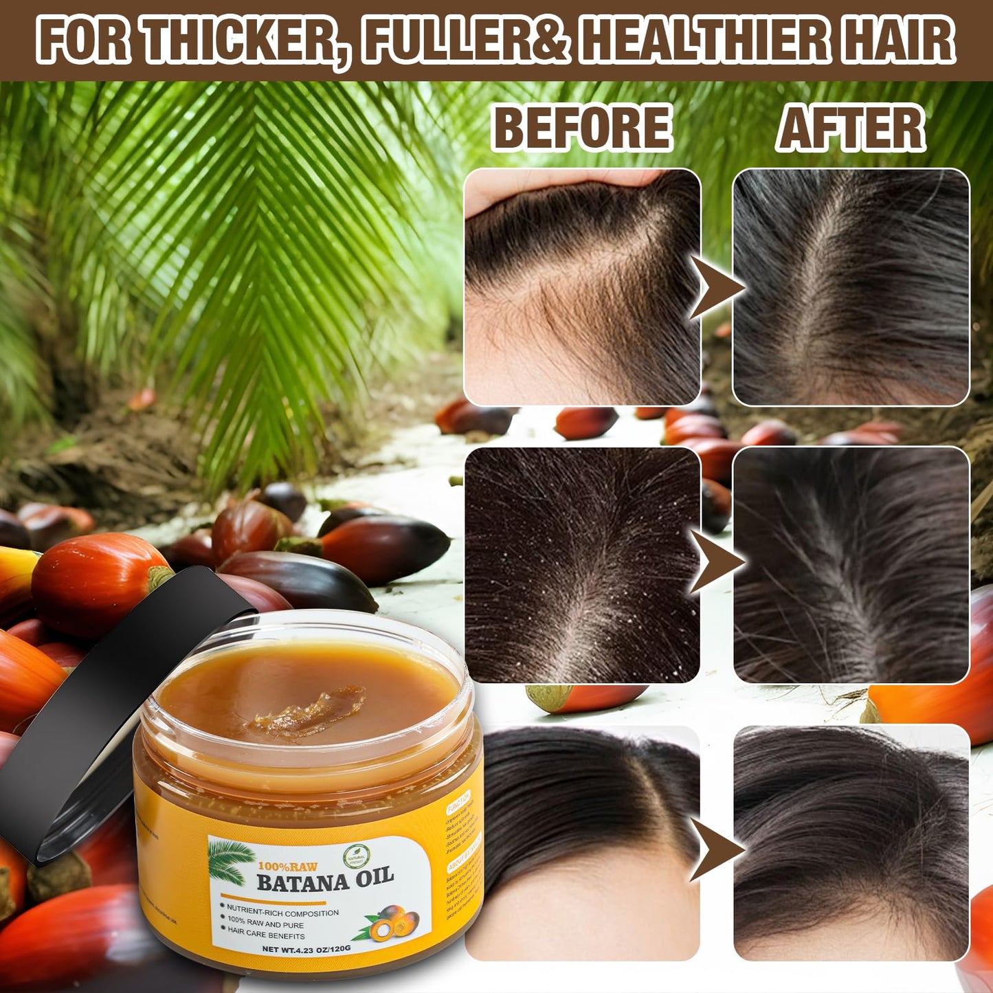 Andreyt Raw Batana Oil for Hair Growth, 100% Natural Pure Dr. Sebi Batana Oil from Honduras, Prevent Hair Loss, Promotes Hair Growth and Thickness Beauty & Personal Care Andreyt
