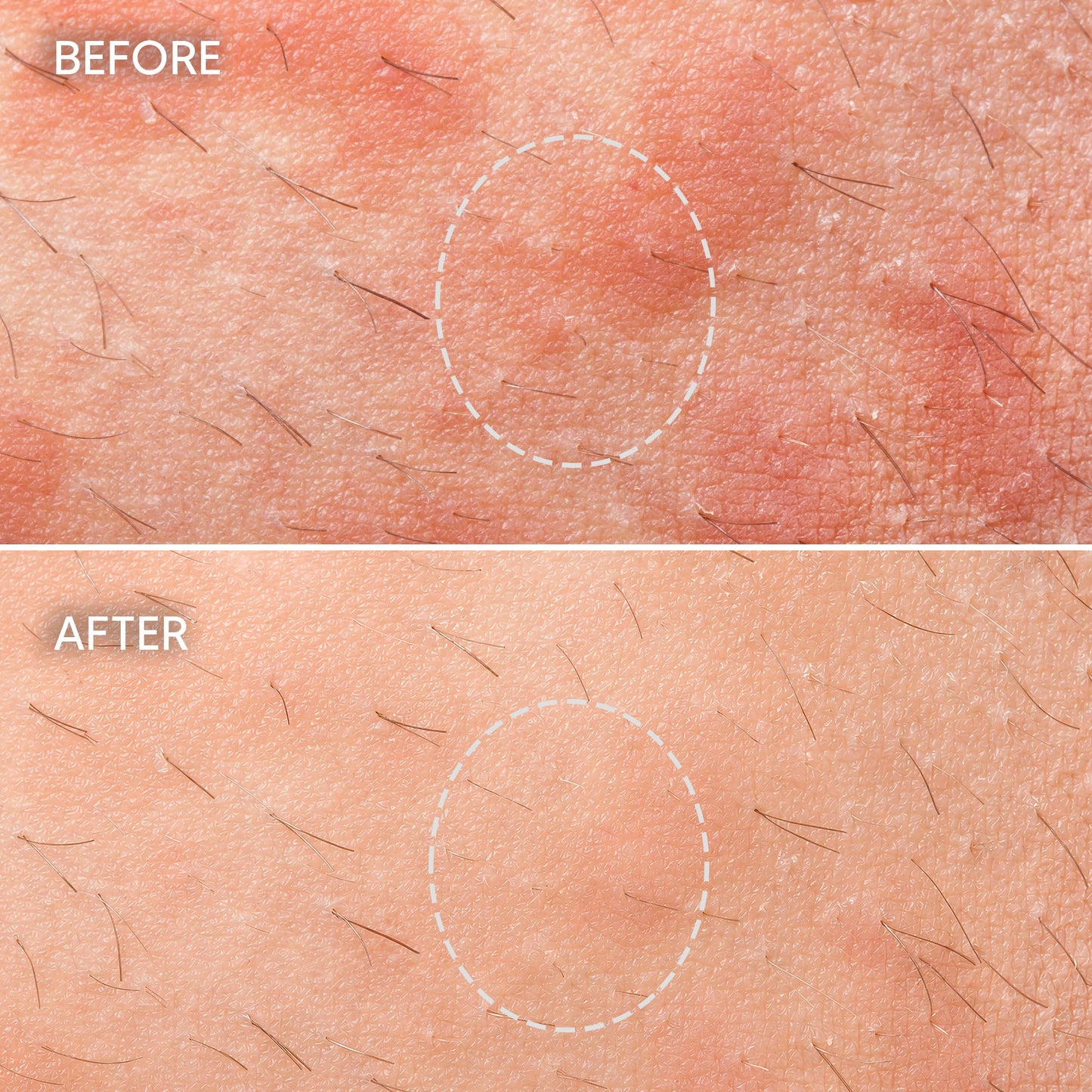 Bye Bye Bumps Body Lotion - Razor Bump and Ingrown Hair Appearance Solution - Post Shave Skin Smoothing Cream for Strawberry Legs - Fragrance Free 2.5 Beauty and Personal Care Cicatrissim