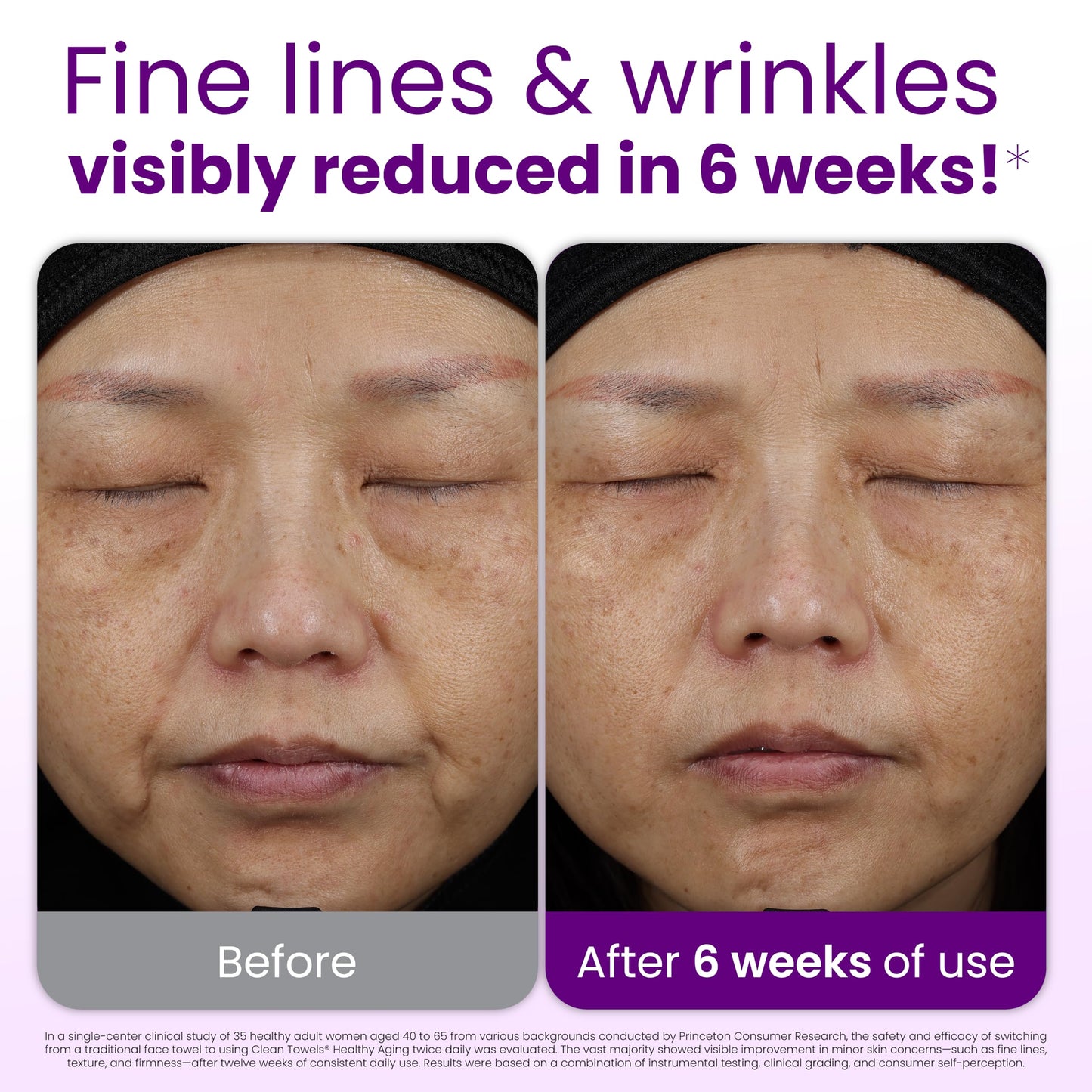 Reduces Fine Lines and Wrinkles in 6 weeks or Less, CLEAN SKIN CLUB Healthy Aging Clean Towels® XL, Disposable Face Towels, XL - 1 Pack (50 count) Beauty and Personal Care CLEAN SKIN CLUB