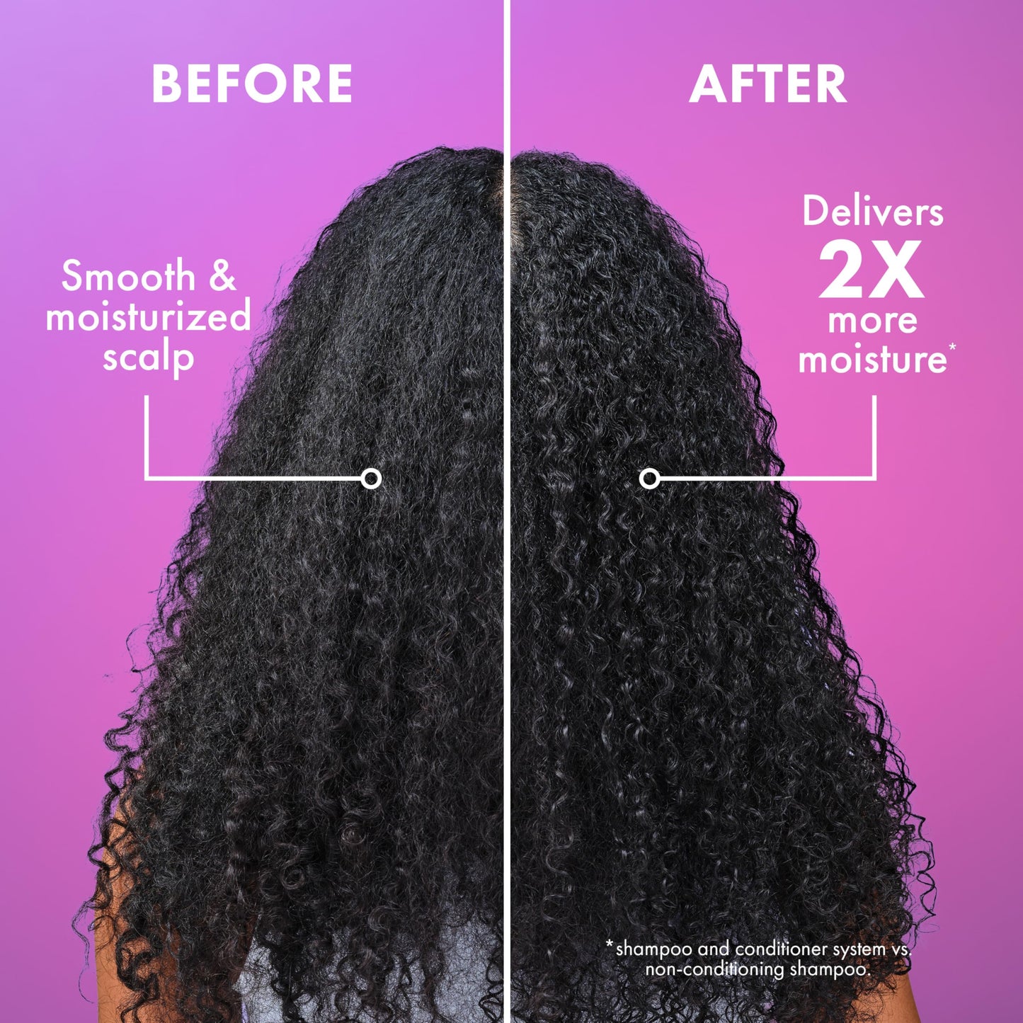 Mielle Organics Lavender & Lychee Scalp Moisturizing Lotion, Leave-In Treatment for Dry Itchy Scalp, Lightweight Scalp Moisturizer with Niacinamide Beauty & Personal Care Mielle Organics