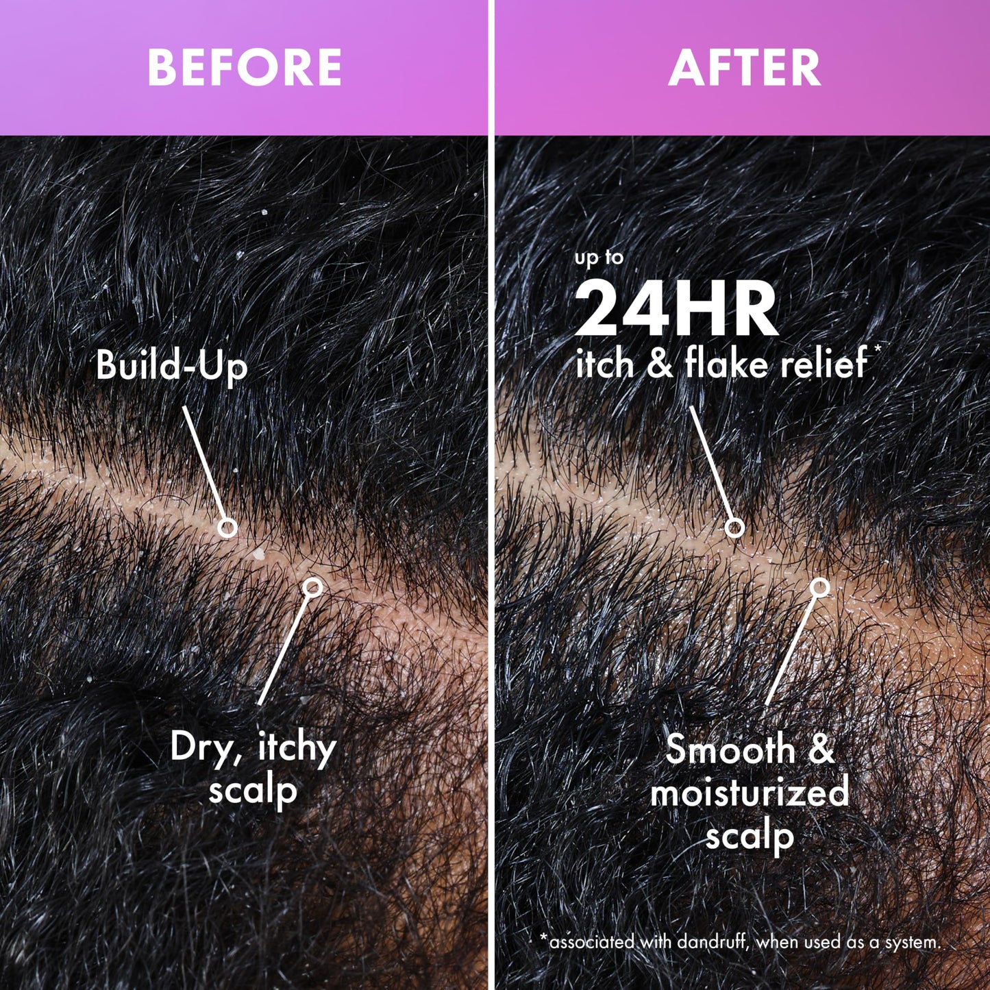 Mielle Organics Lavender & Lychee Scalp Moisturizing Lotion, Leave-In Treatment for Dry Itchy Scalp, Lightweight Scalp Moisturizer with Niacinamide Beauty & Personal Care Mielle Organics