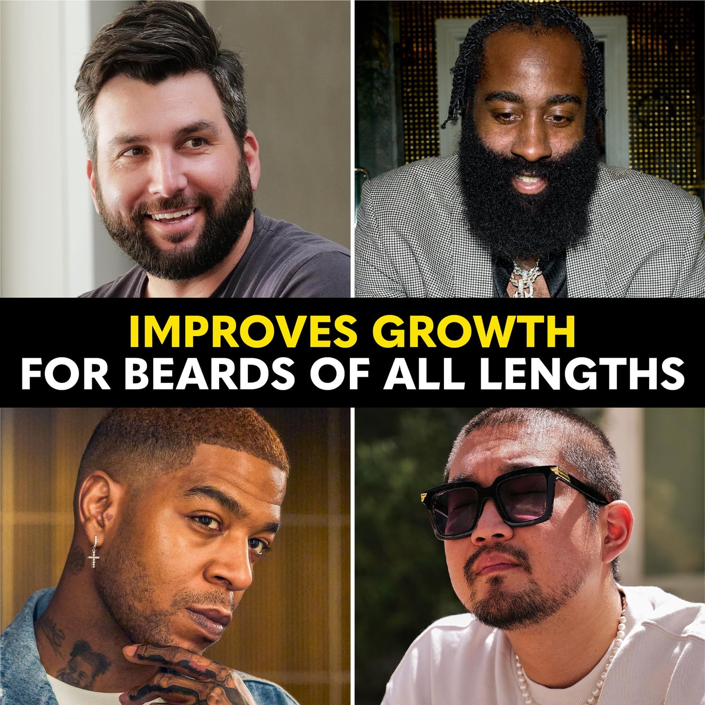The Beard Club - Beard Growth Vitamins - Support A Thicker Fuller Beard, Fill in Patches - Minerals & Multi-Vitamins Help Support and Stimulate Beauty and Personal Care The Beard Club