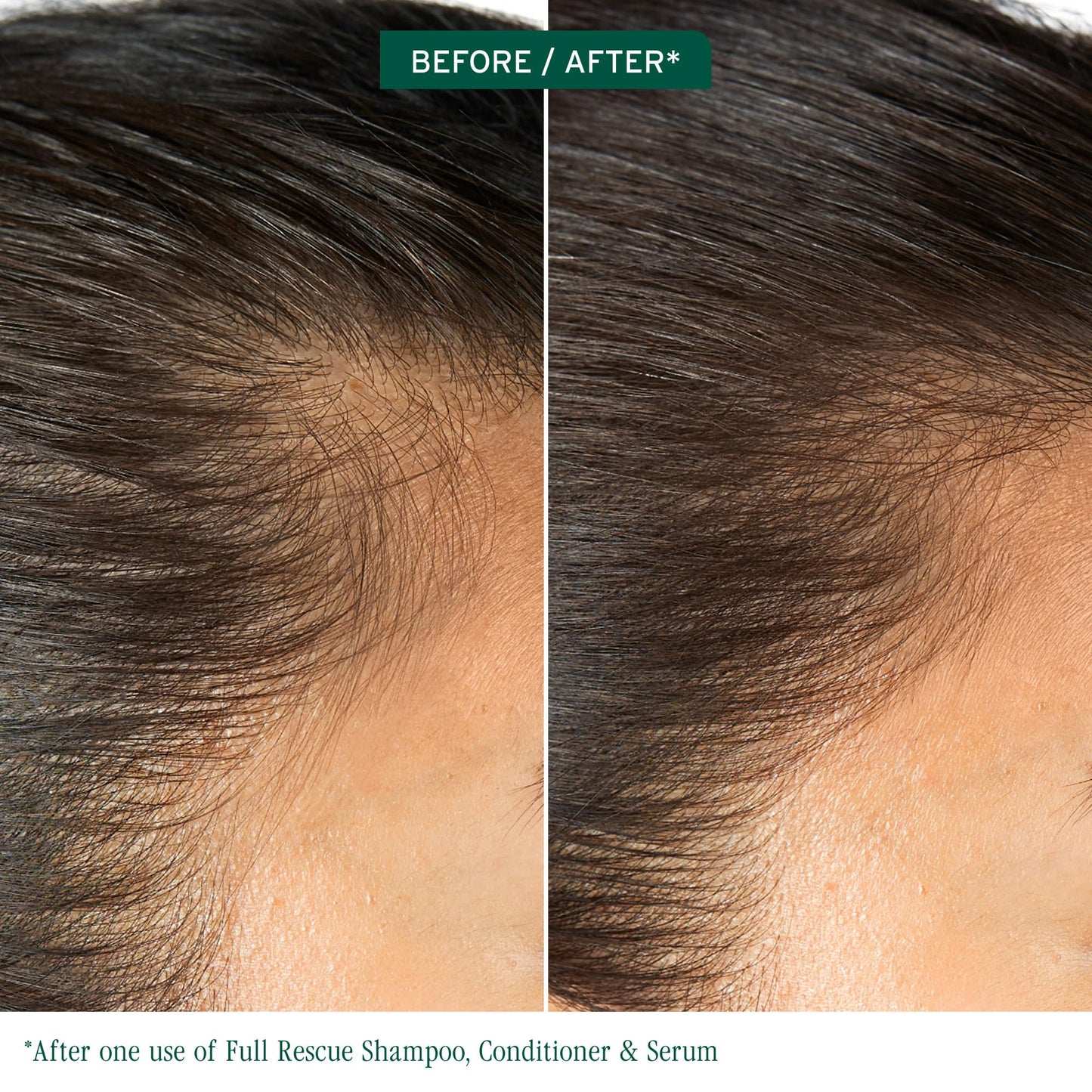 Biolage Full Rescue Conditioner - Fortifies & Strengthens for Stronger Hair, Longer Lengths in 4 weeks*, Instantly Fuller-Looking Hair, Rosemary Oil Beauty & Personal Care Biolage