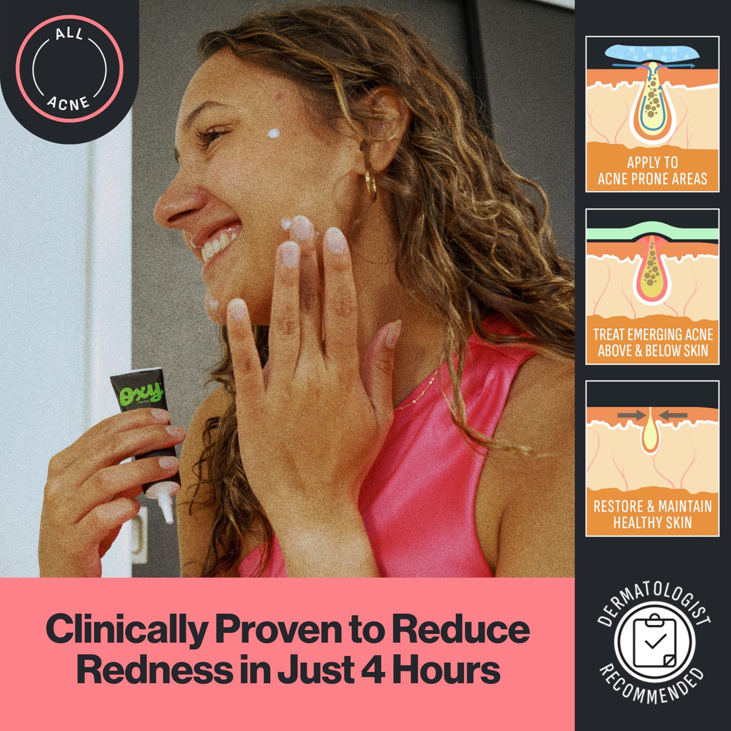 Oxy Rapid Acne Spot Treatment for Face & Body, Maximum Strength 10% Benzoyl Peroxide Blemish Cream Medication for Blackheads, Prebiotic Pimple Cream Beauty & Personal Care Oxy