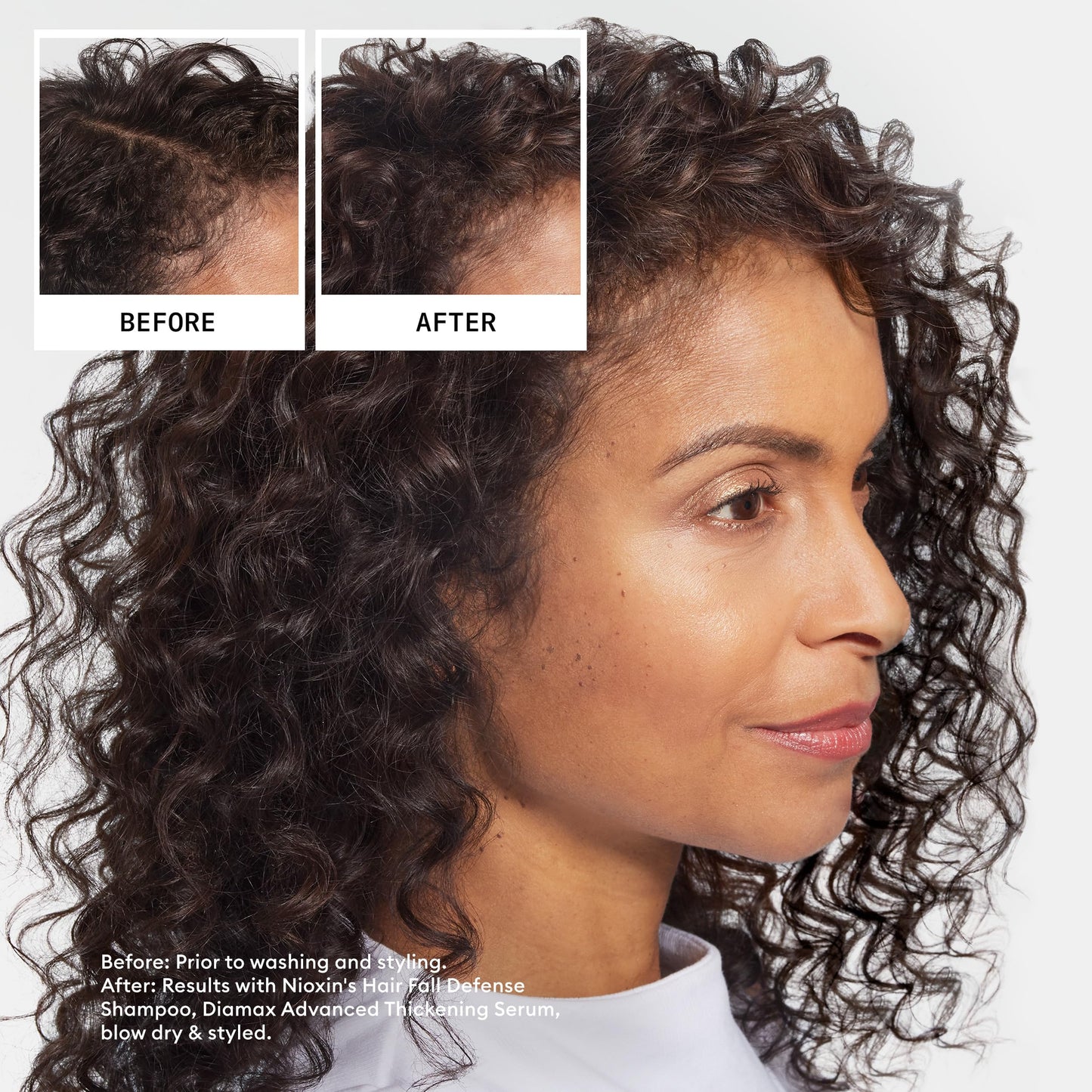 Nioxin Hair Fall Defense Shampoo | Activates Hair Follicles for Visibly Less Hair Loss | With Niacinamide, Caffeine, Lauric Acid, and Sandalore | 33.8 Beauty and Personal Care NIOXIN
