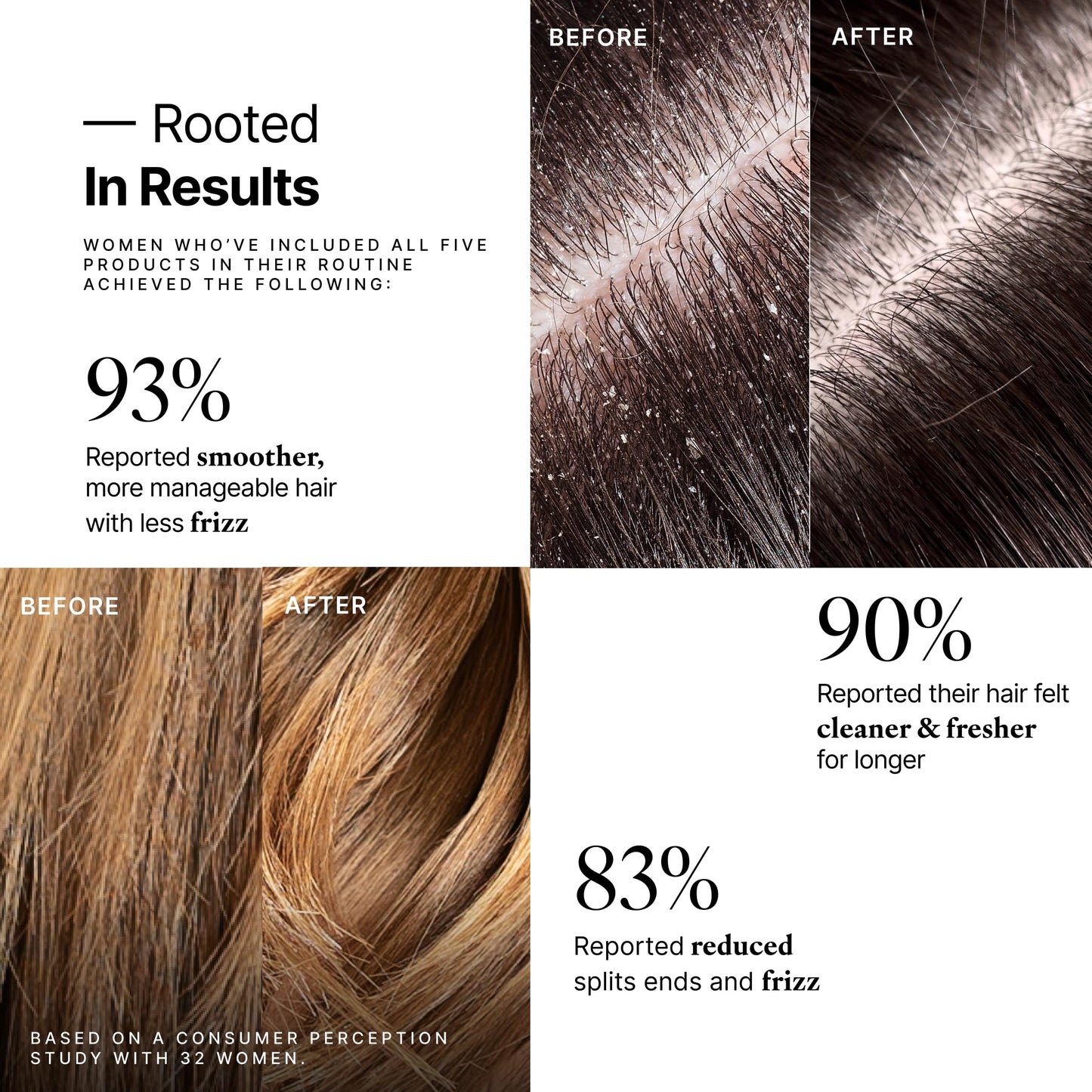 My Way Hair DNA Renewal Set - 5-Step System with Detox & Enhance Shampoos, Conditioner, Leave-In & Repair Oil - Deep Repair, Frizz Control, Shine Beauty & Personal Care MYWAY HAIR DNA PREP