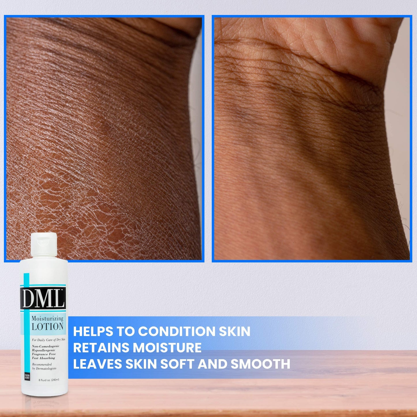 Dml Moisturizing Lotion, Fragrance Free - 8 Oz Beauty & Personal Care DML