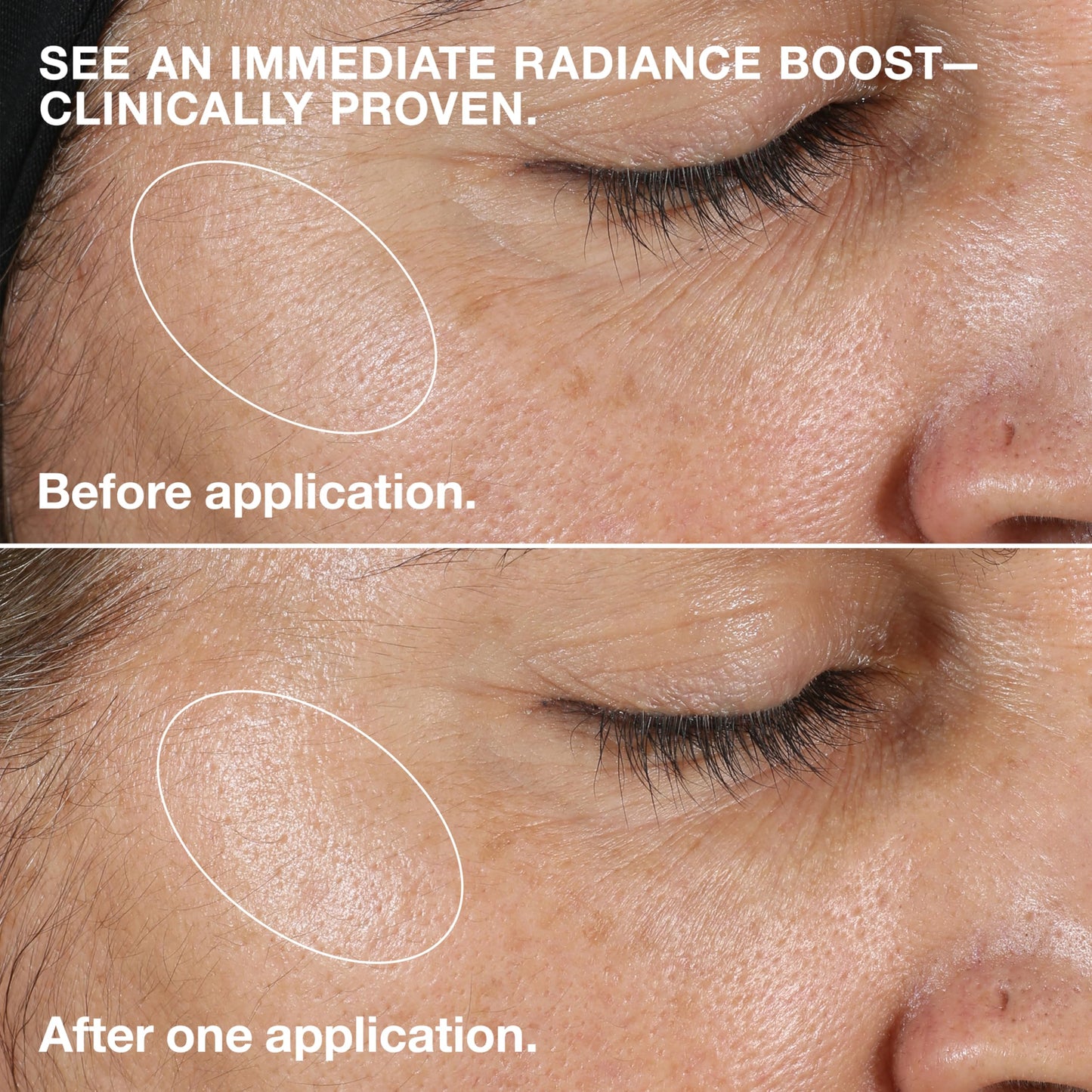 Clinique Clarifying Lotion 2 | Gentle Exfoliator For Dry Combination Skin Types | Face Toner With Witch Hazel | Step 2 in 3-Step Skin Care Routine Beauty and Personal Care Clinique