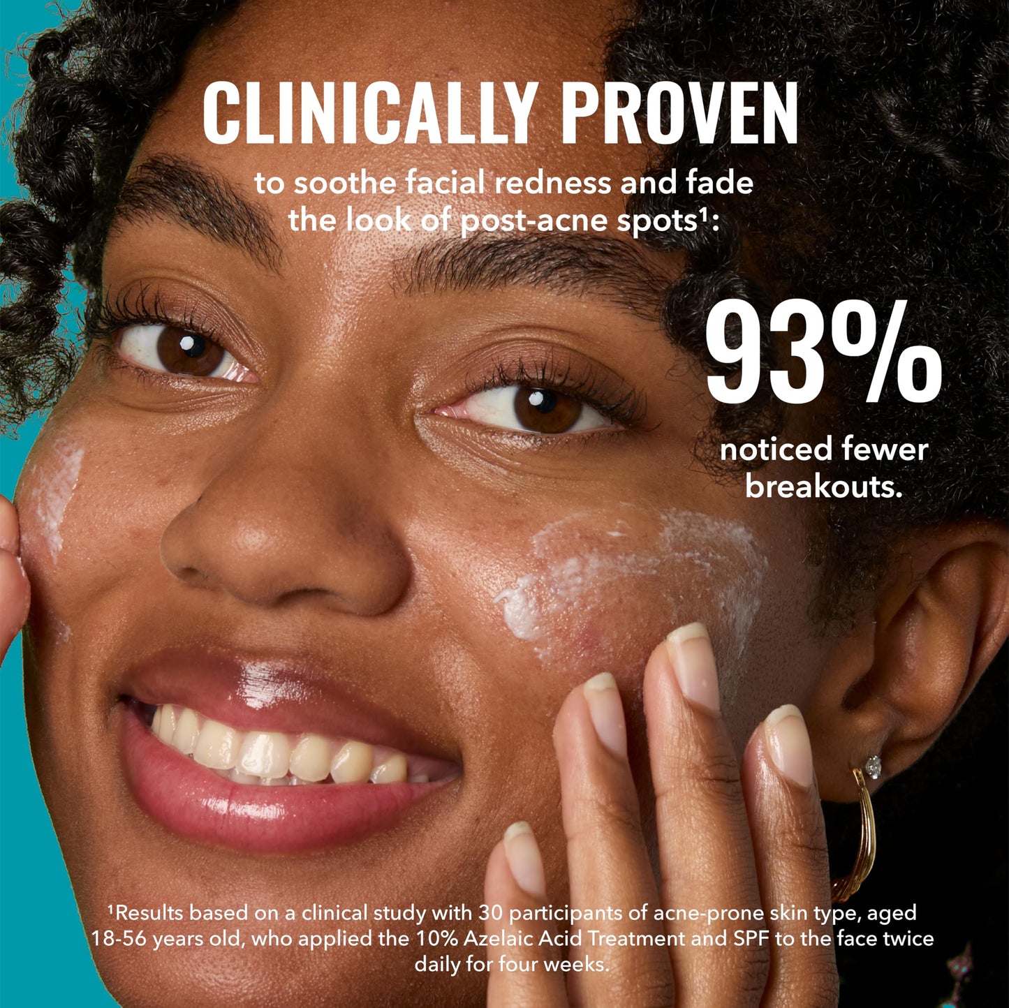 Good Molecules 10% Azelaic Acid Treatment for Face - Blurs Facial Redness & Evens Skin Tone - Brightens the Look of Dark Spots & Refines Texture Beauty and Personal Care Good Molecules