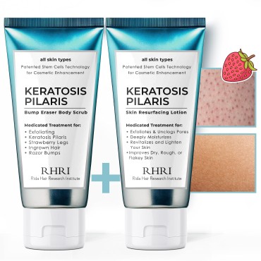 KP Bump Eraser Body Scrub + Keratosis Pilaris Loti...