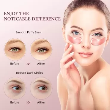 FANMIN Rose Under Eye Patches, Collagen Under Eye ...