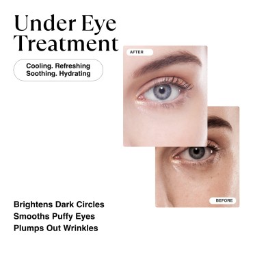 MATKAS Korean Gold Under Eye Patches for Dark Circ...