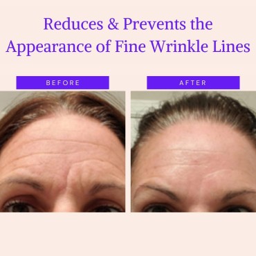 BLUMBODY Face & Forehead Wrinkle Patches - Anti Wr...