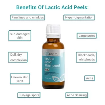 LACTIC Acid 90% Skin Chemical Peel- Alpha Hydroxy (AHA) For Acne, Skin Brightening, Wrinkles, Dry Skin, Age Spots, Uneven Skin Tone, Melasma & More (from Skin Beauty Solutions) - 2oz/ 60ml