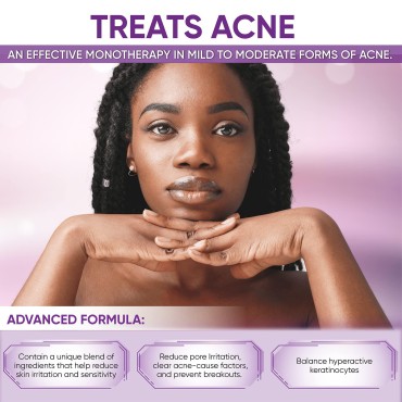 Azelaic Acid 10% Facial Cream, for Redness Relief Face, Rosacea Acne Treatment, Pimple Pigmentation Blackhead, Balance Excess Sebum, Clarify Skin, Soothe Irritation,1 oz