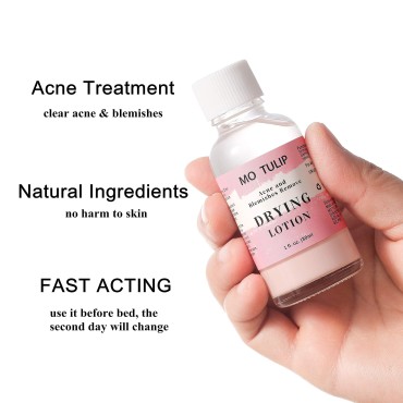 MO TULIP Acne Drying Lotion, Overnight Acne Acid a...