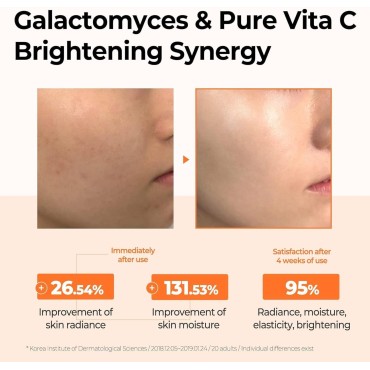 SOME BY MI Galactomyces Pure Vitamin C Glow Toner - 6.76Oz, 200ml - Vitamin C Face Toner for Glass Skin and Skin Brightening Effect - Improvement of Skin Texture and Elasticity - Korean Skin Care