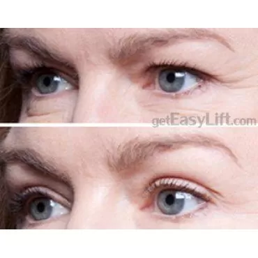 EasyLift The Original 60 Second Eye Lift | As Seen On TV | Lab Tested For Save Everyday Use | Made In America