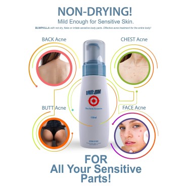 Acne Treatment For Sensitive Skin - 80% of Acne Go...