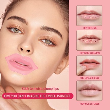 10Pcs Pink Gel Collagen Lip Mask Gel Lip Pads Lip ...