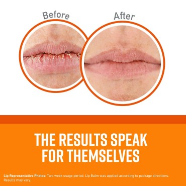 O'Keeffe's Unscented Lip Repair Lip Balm for Dry, ...