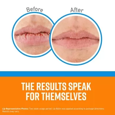 O'Keeffe's Cooling Relief Lip Repair Lip Balm for ...