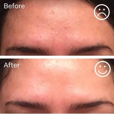 nuorganic Hyaluronic Acid + B5 + Plant Stem Cells:...