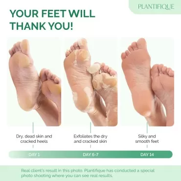 PLANTIFIQUE Foot Peeling Mask - Peeling Foot Mask ...