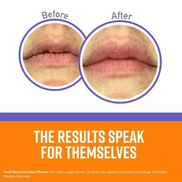 O'Keeffe's Lip Repair Night Treatment Lip Balm (Pa...