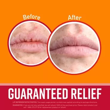O'Keeffe's Lip Repair Lip Balm with Cherry & Vitam...