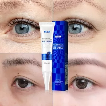 MIESCHER Moisturizing Eye Cream Multi-Effect Eye Essence Remove Eye Bags Dark Circle Fine Line Skin Care Under Eye Cream Treatment for Fine Wrinkles and Puffiness Treatment (Moisturizing Blue)
