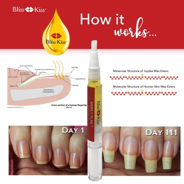 Bliss Kiss | 1 Vanilla Fragrance | Nail Oil Cuticle Pen w/Vitamin E & Jojoba?Nail Strengthener Nail Growth Treatment for Brittle Peeling Breaking Thin Nails