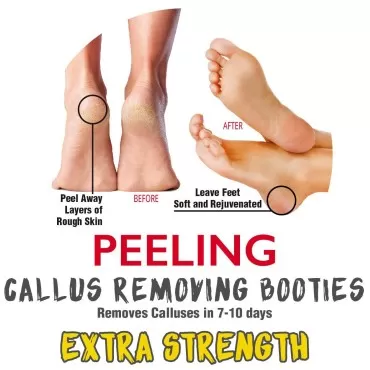 onyx professional Foot Peel Mask Callus Remover (2...