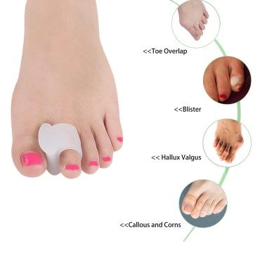 Gel Toe Spacers 12pcs, Toe Separators for Men and ...