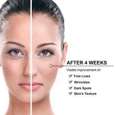Skin Care Carbon Peel Gel Skin Rejuvenation Black Face Doll Facial Skin Deep Cleaning Cream 300ML Elitzia ETBDF30